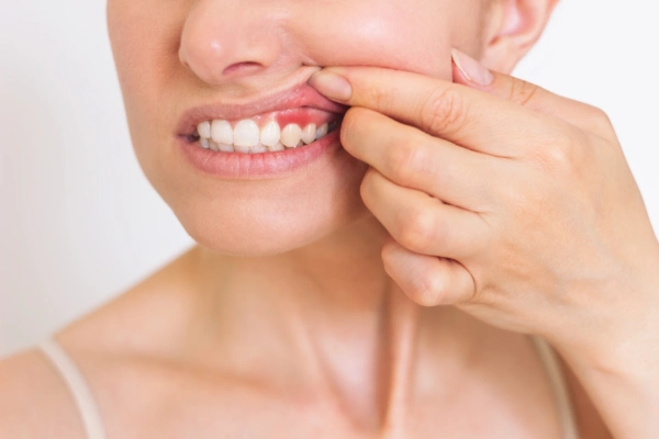 10 síntomas de caries que no debes ignorar