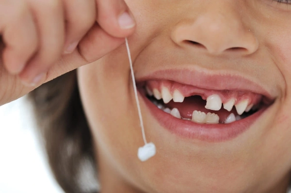 Dientes superiores izquierdos