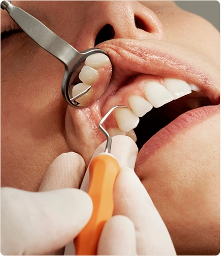Limpieza dental (1)