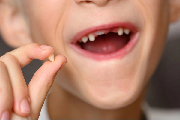 Tipos y nombres de los dientes permanentes