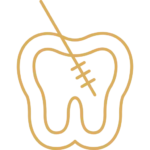 ¿Cómo funciona nuestro tratamiento de endodoncia en Santiago