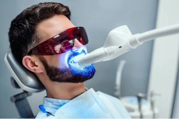 Blanqueamientocon luz o láser