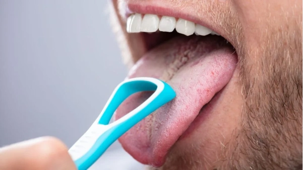 Cómo tratar la lengua blanca en 5 pasos efectivos