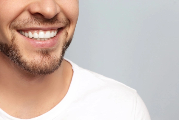 Nuestros tratamientos en el diseño de sonrisa