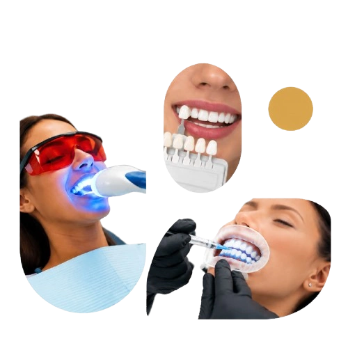 Preguntas frecuentes sobre nuestro blanqueamiento dental