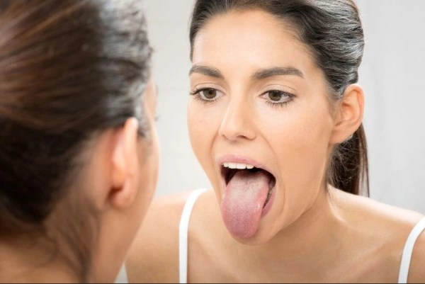 Síntomas que pueden acompañar a las heridas en la lengua