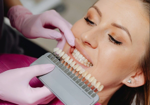 Tipos de blanqueamiento dental