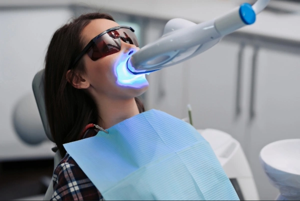 ¿Por qué elegir nuestro blanqueamiento dental