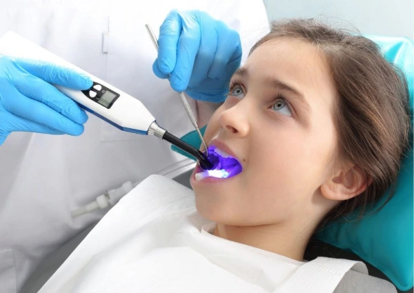 ¿Qué es el flúor y cómo actúa en los dientes?
