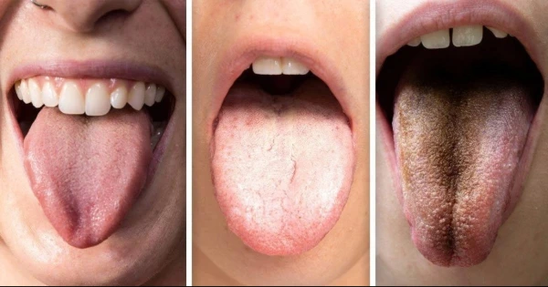 10 colores de la lengua causas y significado