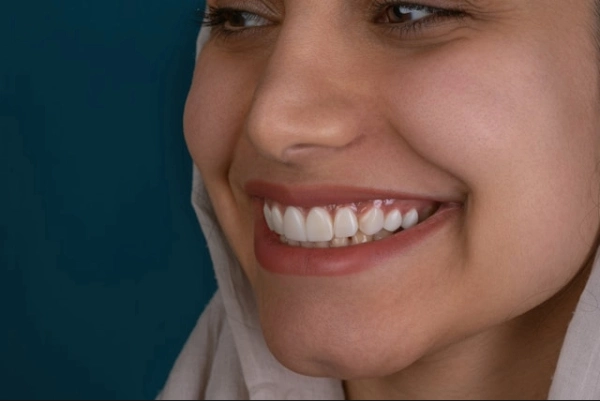 10 consejos sobre cómo blanquear los dientes de forma segura y efectiva