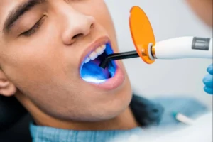 Cómo blanquear los dientes 10 consejos útiles