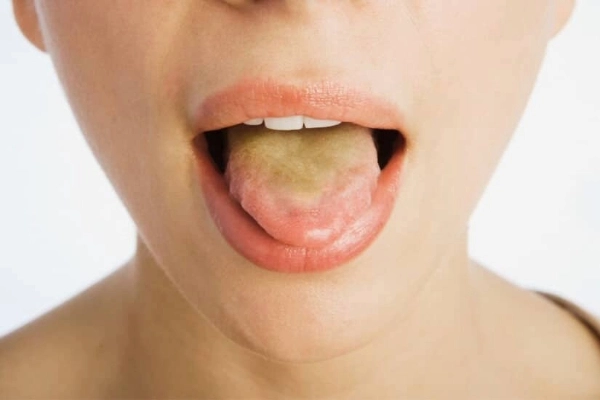 Los 10 colores de la lengua y su significado