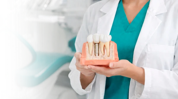 Preguntas frecuentes sobre nuestros convenios dentales