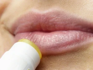 ¿Cómo eliminar herpes labial en horas