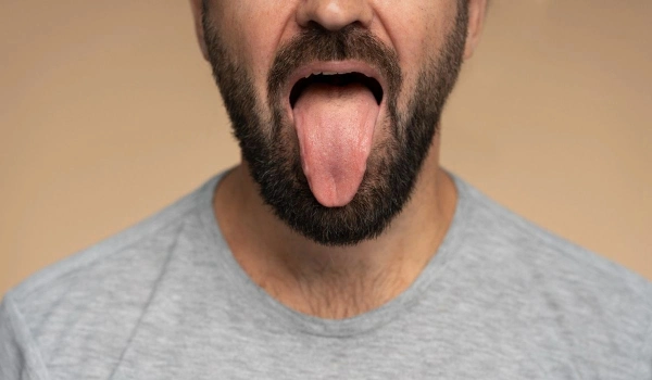 ¿Cómo recuperar el color normal de la lengua?