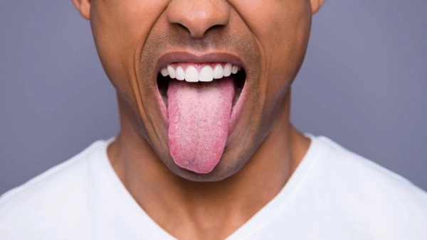 ¿Cuál es el color normal de la lengua y por qué puede cambiar?